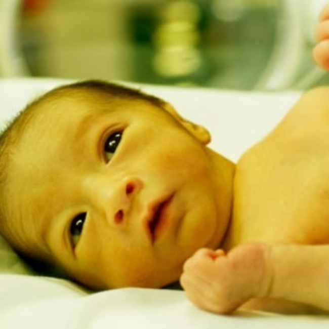 Vàng da bệnh lý ở trẻ sơ sinh có thể gây ra nhiều biến chứng nguy hiểm nếu không được điều trị kịp thời (Ảnh: Internet)