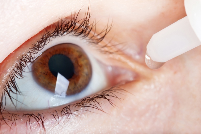 Thực hư thuốc nhỏ mắt chữa cận thị hiệu quả? - Ảnh 2.