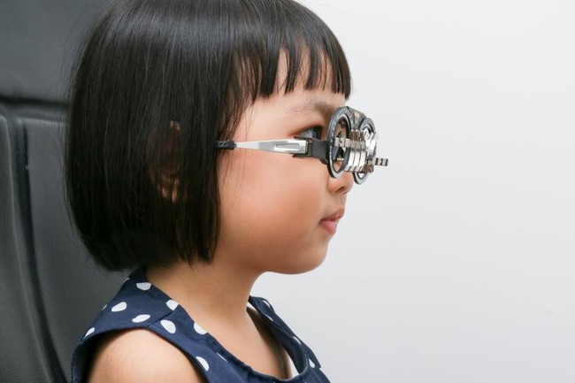 Một số câu hỏi thường gặp về cận thị: Bị cận thị có di truyền không? - Ảnh 2.