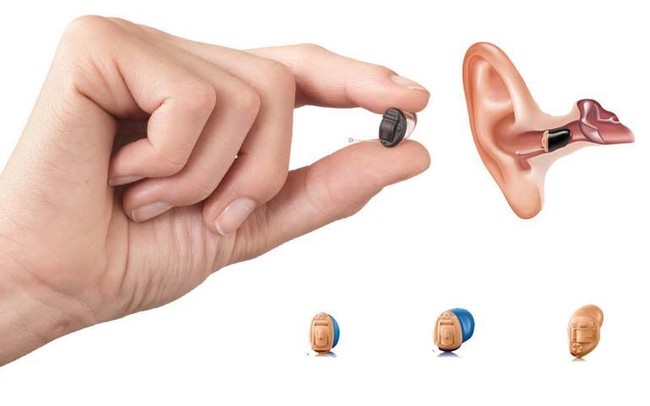 4 điều cần lưu ý khi mua máy trợ thính cho người già - Ảnh 2.