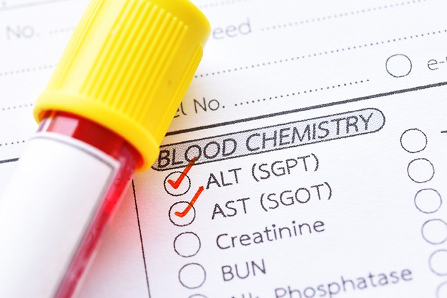 Chỉ số AST là gì? Những điều cần biết về chỉ số AST trong xét nghiệm máu - Ảnh 3.