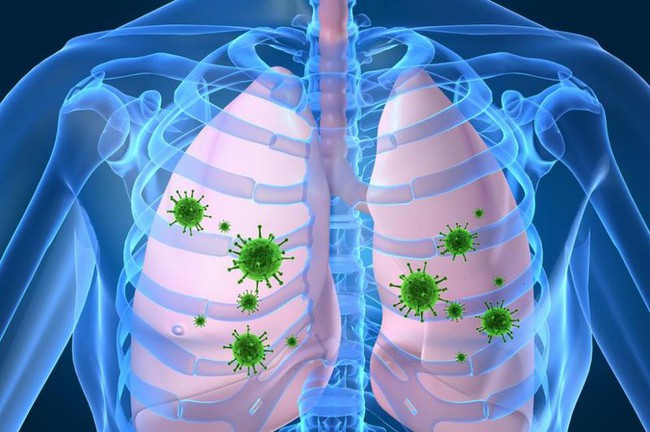 Viêm phổi ở người già: Nguyên nhân, triệu chứng điều trị và cách phòng tránh - Ảnh 1.