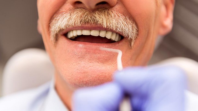 Bệnh răng miệng ở người cao tuổi: Tại sao người già hay bị rụng răng và hướng dẫn chăm sóc răng miệng đúng cách - Ảnh 5.