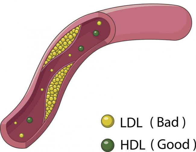 Nồng độ cholesterol trong máu ở từng lứa tuổi như thế nào là phù hợp? - Ảnh 2.