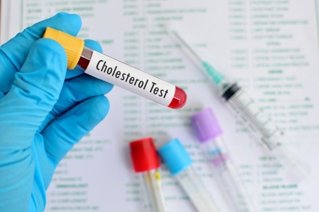 Nồng độ cholesterol trong máu ở từng lứa tuổi như thế nào là phù hợp? - Ảnh 3.