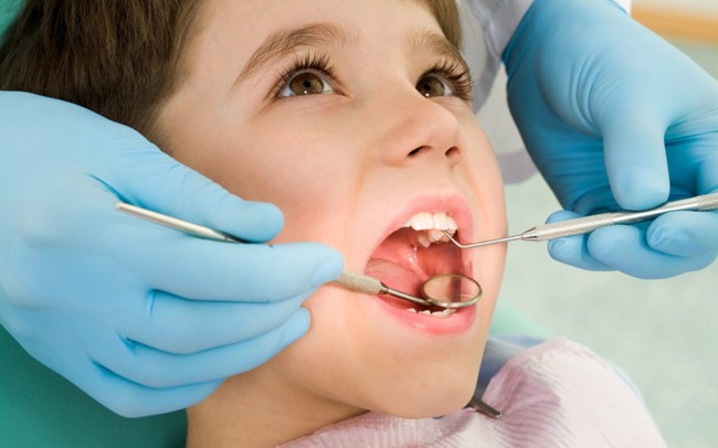 Sâu răng ở trẻ em là gì? Điều trị sâu răng ở trẻ em bằng cách nào? - Ảnh 4.