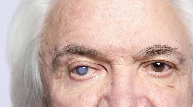 9 bệnh lý gây biến chứng mờ mắt phổ biến nhất - Ảnh 2.