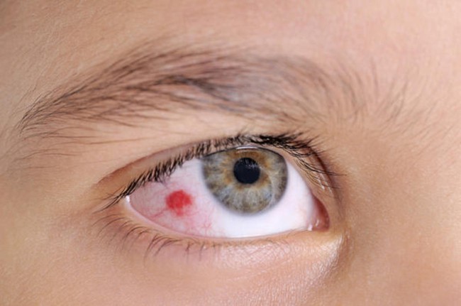 9 bệnh lý gây biến chứng mờ mắt phổ biến nhất - Ảnh 1.