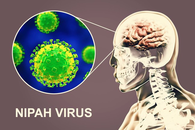 Chuyên gia nói gì về chủng virus Nipah có thể gây chết người gấp 75 lần virus SARS-CoV-2 - Ảnh 3.