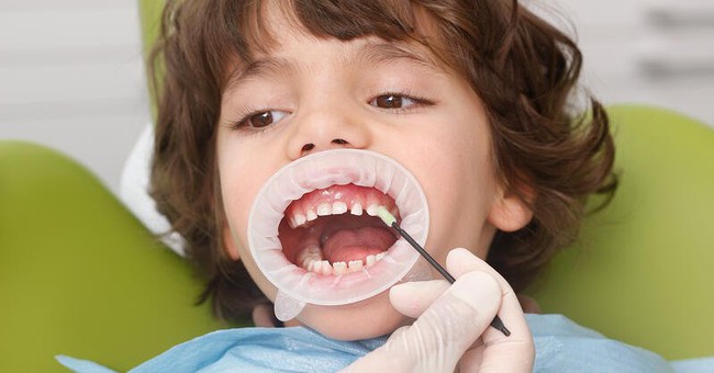 Tự nhổ răng sữa tại nhà, răng bé gái 8 tuổi bị rơi vào phổi dẫn tới viêm phổi nặng - Ảnh 6.