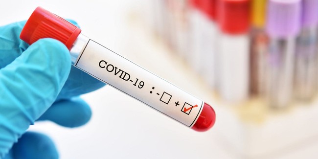 Phát hiện mới: Nhóm máu A có khả năng dễ nhiễm COVID-19 và triệu chứng chứng nặng hơn - Ảnh 3.