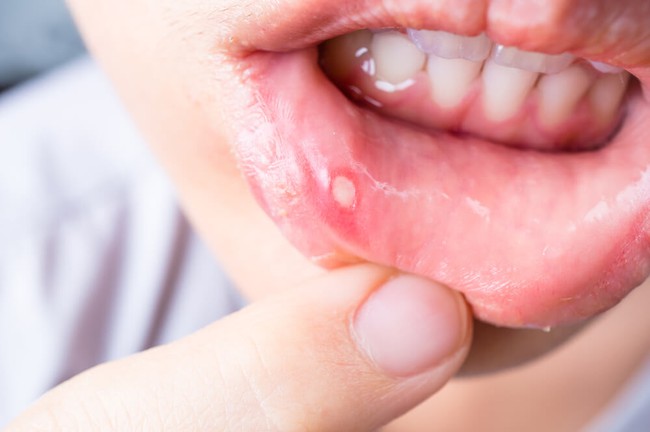 Mối liên hệ giữa Covid-19 và sức khỏe răng miệng - Ảnh 5.