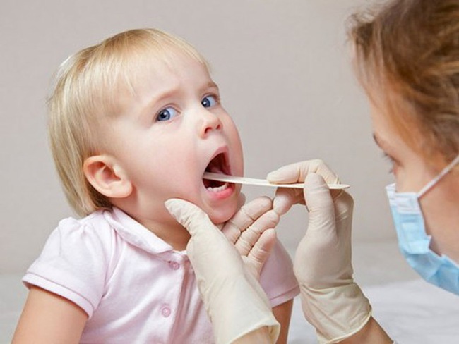 Tại sao viêm họng mùa hè ở trẻ gia tăng? Phòng ngừa bằng cách nào? - Ảnh 3.