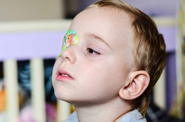 Bệnh nháy mắt ở trẻ em: Nguyên nhân và hướng điều trị - Ảnh 4.