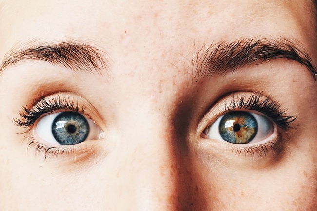 Loạn sắc tố mống mắt (Heterochromia Iridium): Nguyên nhân, dấu hiệu và cách điều trị - Ảnh 3.