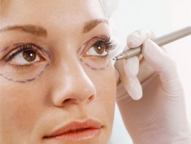 Bệnh mắt lồi: Nguyên nhân, triệu chứng và cách điều trị bệnh - Ảnh 3.