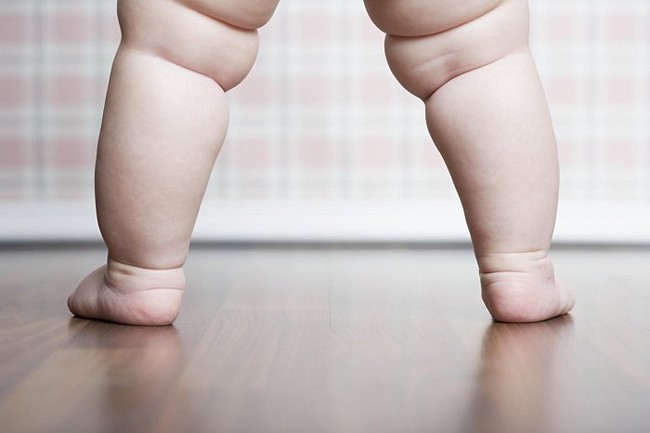 Chân trẻ sơ sinh bị cong: Nguyên nhân và cách phòng tránh - Ảnh 1.
