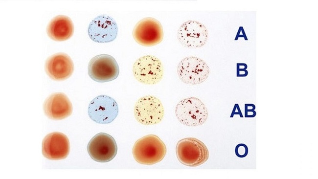 Hiểu đúng và đủ về các nhóm máu hiếm hiện nay như thế nào? - Ảnh 2.
