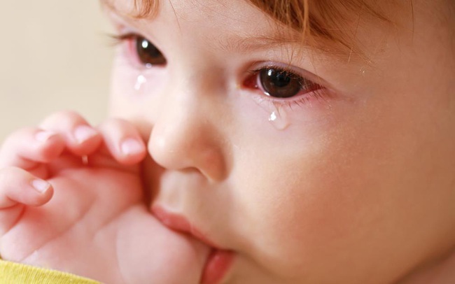 Tìm hiểu 5 căn bệnh đau mắt ở trẻ sơ sinh phổ biến và cách phòng tránh cho cha mẹ - Ảnh 3.