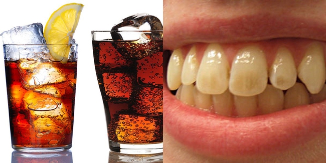 Tổng hợp những nguyên nhân răng bị xỉn màu - Ảnh 3.