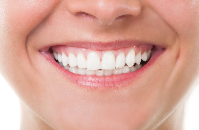 Tụt nướu răng là gì? Gợi ý cách trị tụt nướu răng tại nhà hiệu quả - Ảnh 3.