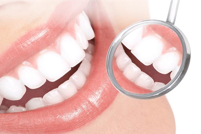 Răng không đều phải làm sao? Bật mí những cách chỉnh nha để có hàm răng đẹp - Ảnh 2.