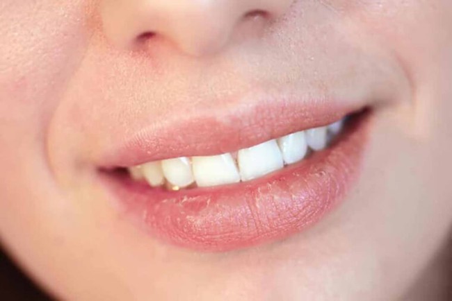 Tại sao bị ngứa nướu răng? Thông tin từ A tới Z về ngứa nướu răng - Ảnh 1.