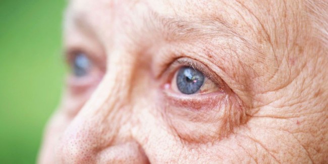 Hướng dẫn cách điều trị mắt bị mờ an toàn, hiệu quả tại nhà - Ảnh 5.