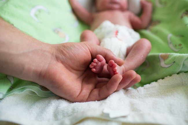 hội chứng đột tử ở trẻ sơ sinh