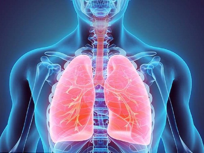 Viêm phế quản có chuyển thành viêm phổi không? - Ảnh 2.