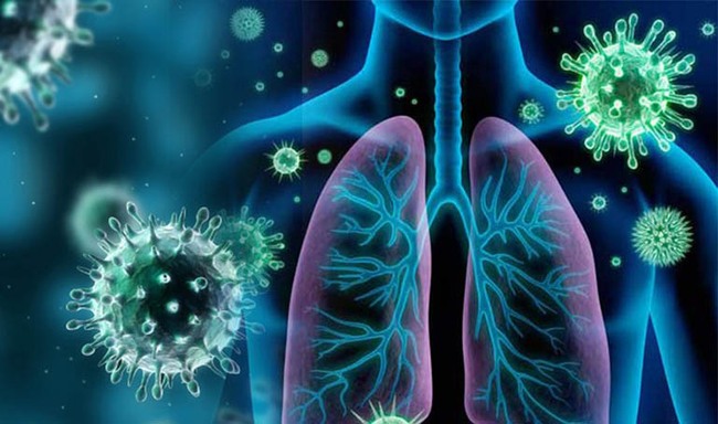 Viêm phế quản có chuyển thành viêm phổi không? - Ảnh 4.