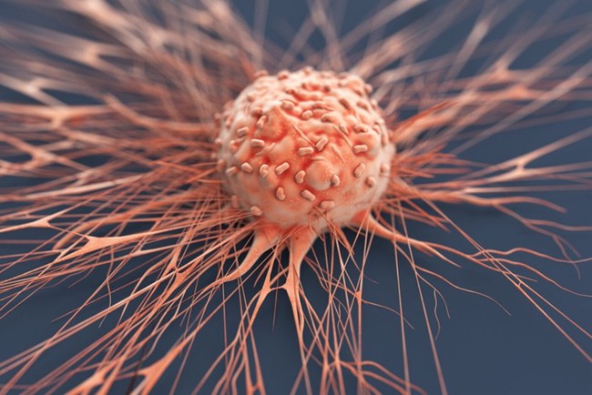 Liệu pháp miễn dịch trong điều trị ung thư: Hy vọng mới cho bệnh nhân mắc ung thư - Ảnh 3.