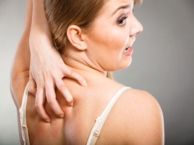 Lưng bị nổi mẩn đỏ ngứa là bệnh gì? Nguyên nhân và cách xử lý - Ảnh 3.
