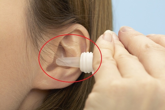 Nguyên nhân, triệu chứng, biện pháp khắc phục vành tai có vảy trắng  - Ảnh 4.