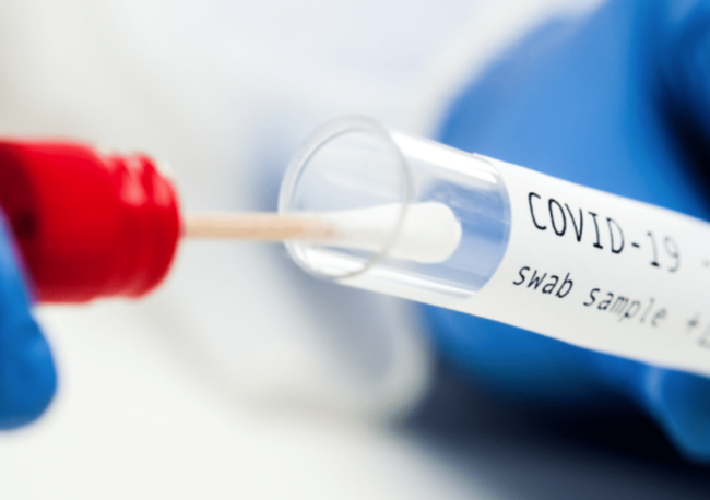 Nghiên cứu mới: Xét nghiệm nước tiểu có thể là tương lai trong xét nghiệm kháng thể Covid-19? - Ảnh 2.