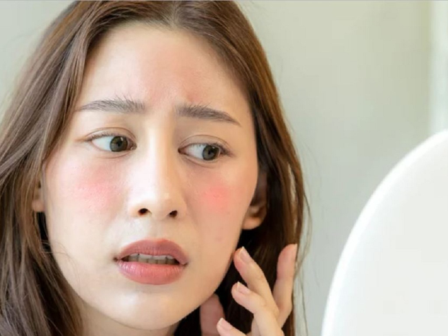 Nguyên nhân và cách điều trị khi bị ngứa da mặt nhưng không nổi mẩn - Ảnh 3.