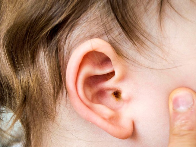 4 sai lầm làm trẻ mắc bệnh tai mũi họng khi giao mùa - Ảnh 2.