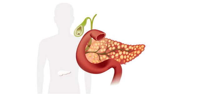 Bệnh Sau Tết: Nhận biết triệu chứng viêm tụy cấp, tránh nhầm lẫn với bệnh tiêu hóa - Ảnh 3.