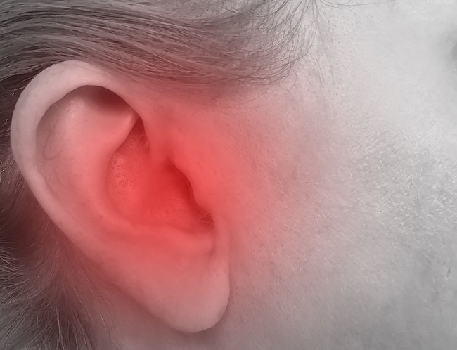 5 nguyên nhân gây đau nhói trong tai và cách điều trị - Ảnh 2.