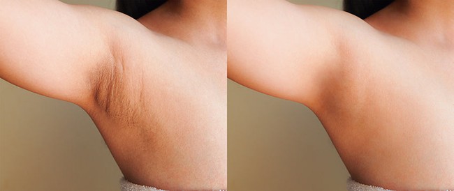 TikTok Đúng hay Sai: Dùng chanh giảm thâm vùng da dưới cánh tay có thực sự hiệu quả? - Ảnh 4.