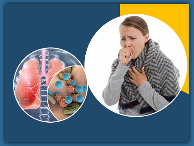 Các loại nấm gây viêm phổi và cách phòng ngừa - Ảnh 3.