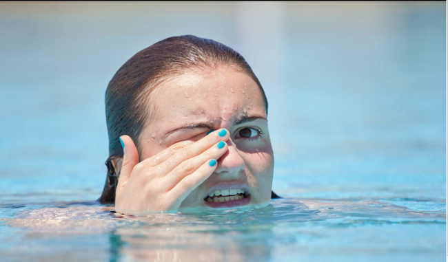 Mẹo giữ đôi mắt khỏe mạnh khi đi bơi vào mùa hè - Ảnh 4.