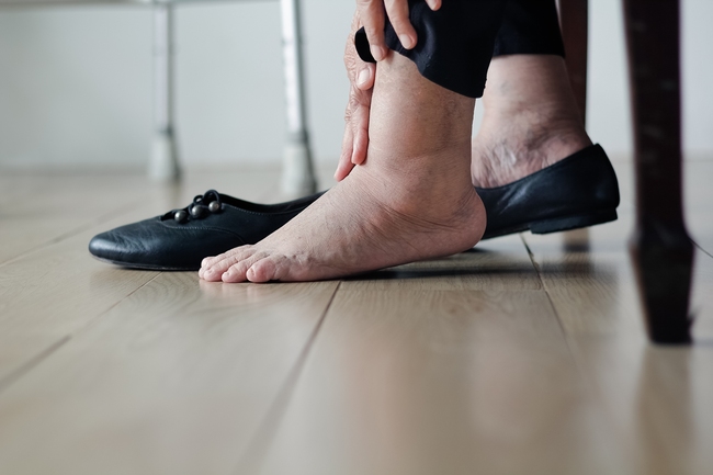 Cách để giảm đau chân khi viêm khớp dạng thấp vào mùa - Ảnh 5.