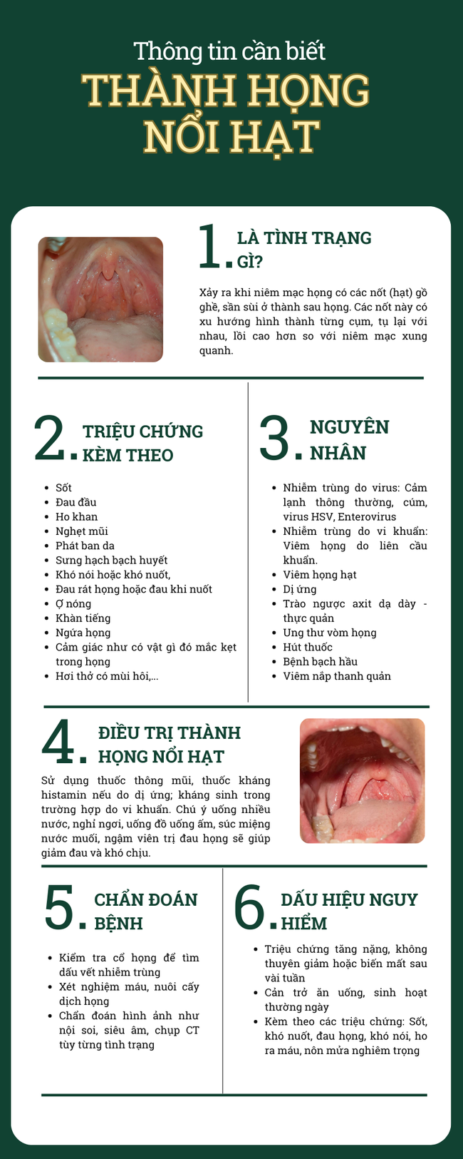 Thành họng nổi cục, nổi hạt là bệnh gì? Có phải ung thư họng không? - Ảnh 6.