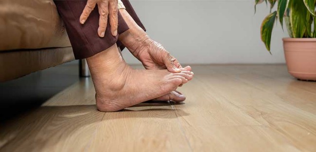 Sưng phù bàn chân là bệnh gì? Sưng bàn chân có phải dấu hiệu bệnh tiểu đường? - Ảnh 7.