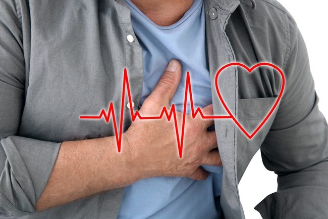 Những điều cần biết về hội chứng QT kéo dài, tình trạng có thể gây đột tử tim - Ảnh 2.