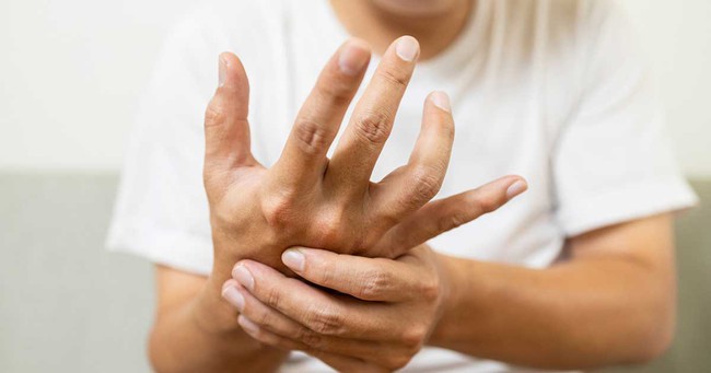 Bong gân ngón tay: Dấu hiệu nhận biết và cách điều trị - Ảnh 2.