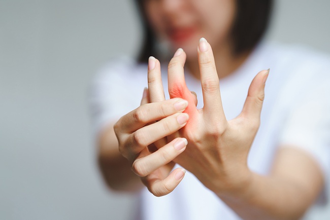 6 cách giảm đau tay do viêm khớp dạng thấp khi giao mùa - Ảnh 3.