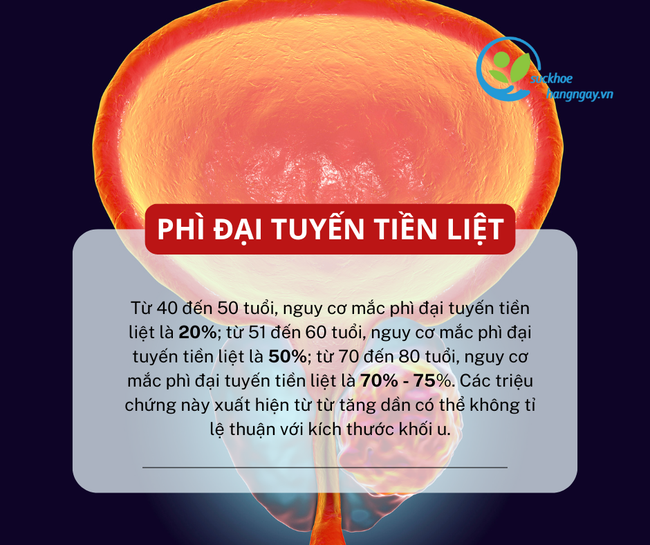 6 nguy cơ sức khỏe thường gặp ở nam giới sau tuổi 40 - Ảnh 4.
