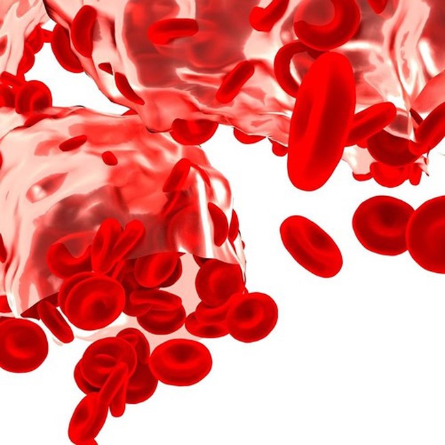 10 căn bệnh về máu thường gặp và dấu hiệu điển hình - Ảnh 3.